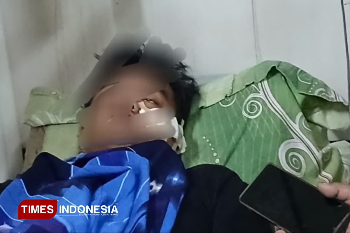 Pengemudi GrabCar Alami Luka Parah di Wajah Usai Dibacok OTK di Pertigaan Stasiun Banjar